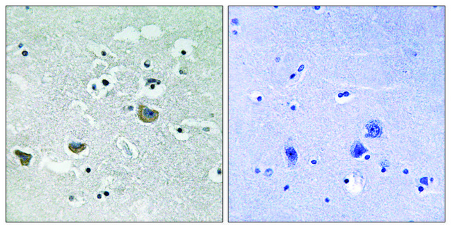 Anti-SREBP-1 antibody produced in rabbit affinity isolated antibody