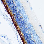 Anti-Rhodopsin Antibody, clone 5N3G9, Rabbit Monoclonal