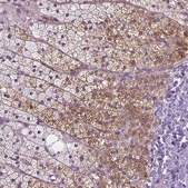 Anti-MCOLN3 antibody produced in rabbit Prestige Antibodies&#174; Powered by Atlas Antibodies, affinity isolated antibody, buffered aqueous glycerol solution