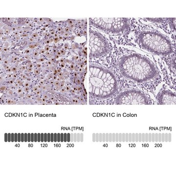 Anti-CDKN1C antibody produced in rabbit Prestige Antibodies&#174; Powered by Atlas Antibodies, affinity isolated antibody, buffered aqueous glycerol solution