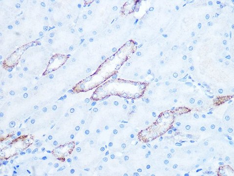 Anti-IRAK2 antibody produced in rabbit