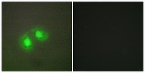 Anti-TOP2A antibody produced in rabbit affinity isolated antibody