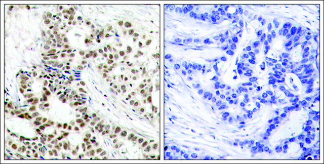Anti-phospho-BRCA1 (pSer1423) antibody produced in rabbit affinity isolated antibody