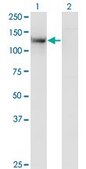 Monoclonal Anti-SDCCAG33 antibody produced in mouse clone 2F1, purified immunoglobulin, buffered aqueous solution