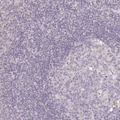 Anti-SEZ6L2 antibody produced in rabbit Prestige Antibodies&#174; Powered by Atlas Antibodies, affinity isolated antibody, buffered aqueous glycerol solution