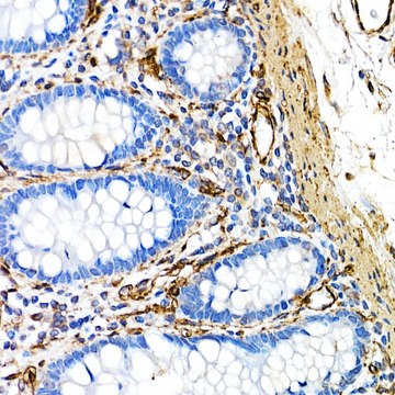 Anti-Caveolin-1 Antibody, clone 10Y5L2, Rabbit Monoclonal