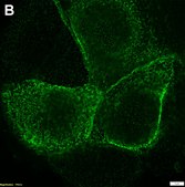 Anti-CFTR Antibody, clone MM13-4 ZooMAb&#174; Mouse Monoclonal recombinant, expressed in HEK 293 cells