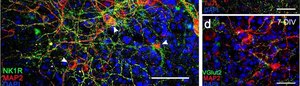 Anti-K+/Cl- Cotransporter (KCC2) Antibody Upstate&#174;, from rabbit