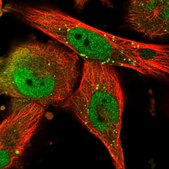 Anti-TRIM8 antibody produced in rabbit Prestige Antibodies&#174; Powered by Atlas Antibodies, affinity isolated antibody, buffered aqueous glycerol solution, ab2