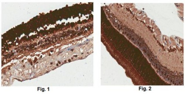 Anti-Recoverin Antibody from rabbit, purified by affinity chromatography