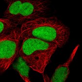 Anti-HMGN1 antibody produced in rabbit Prestige Antibodies&#174; Powered by Atlas Antibodies, affinity isolated antibody, buffered aqueous glycerol solution