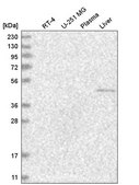 Anti-NR6A1 antibody produced in rabbit Prestige Antibodies&#174; Powered by Atlas Antibodies, affinity isolated antibody