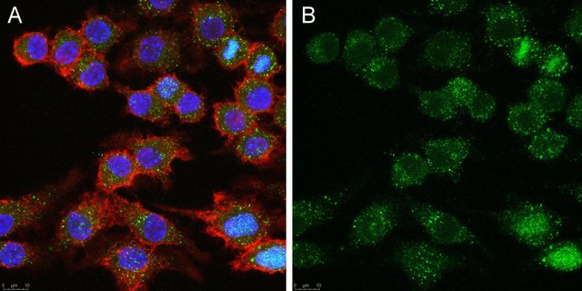 Anti-CD25 Antibody, clone 7D4