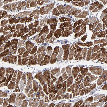 Anti-ZNF175 antibody produced in rabbit Prestige Antibodies&#174; Powered by Atlas Antibodies, affinity isolated antibody, buffered aqueous glycerol solution