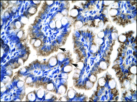 Anti-ATF5 (AB1) antibody produced in rabbit affinity isolated antibody