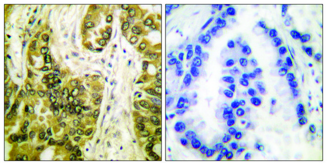 Anti-Galectin 3 antibody produced in rabbit affinity isolated antibody