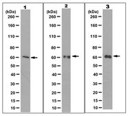 Anti-hIAP-1/BIRC3 Antibody, clone 11D12.1 clone 11D12.1, from mouse