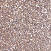 Anti-VMO1 antibody produced in rabbit Prestige Antibodies&#174; Powered by Atlas Antibodies, affinity isolated antibody, buffered aqueous glycerol solution