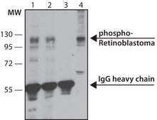 Monoclonal Anti-phospho-Retinoblastoma (pSer795) antibody produced in mouse ~2&#160;mg/mL, clone RB-10, purified immunoglobulin, buffered aqueous solution