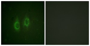 Anti-Connexin 43 antibody produced in rabbit affinity isolated antibody