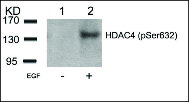 Anti-phospho-HDAC4 (pSer632) antibody produced in rabbit affinity isolated antibody