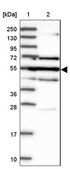 Anti-GAL3ST4 antibody produced in rabbit Prestige Antibodies&#174; Powered by Atlas Antibodies, affinity isolated antibody, buffered aqueous glycerol solution