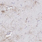 Anti-NR2E1 antibody produced in rabbit Prestige Antibodies&#174; Powered by Atlas Antibodies, affinity isolated antibody, buffered aqueous glycerol solution
