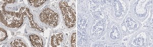 Anti-EZHIP/CXorf67 Antibody, clone 1J8 ZooMAb&#174; Rabbit Monoclonal recombinant, expressed in HEK 293 cells