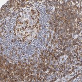 Anti-CD2 antibody produced in rabbit Prestige Antibodies&#174; Powered by Atlas Antibodies, affinity isolated antibody, buffered aqueous glycerol solution