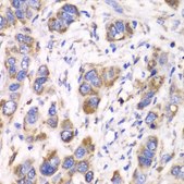 Anti-ALDH2 antibody produced in rabbit