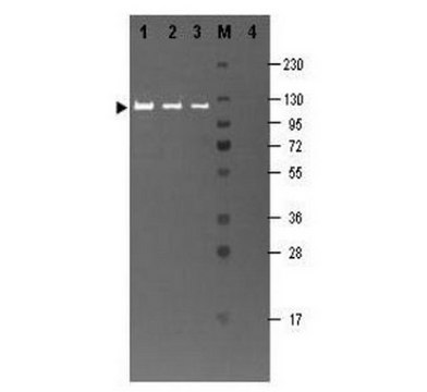 Anti-&#946; Galactosidase Antibody Chemicon&#174;, from rabbit