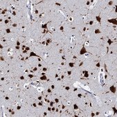 Anti-CELF2 antibody produced in rabbit Prestige Antibodies&#174; Powered by Atlas Antibodies, affinity isolated antibody, buffered aqueous glycerol solution