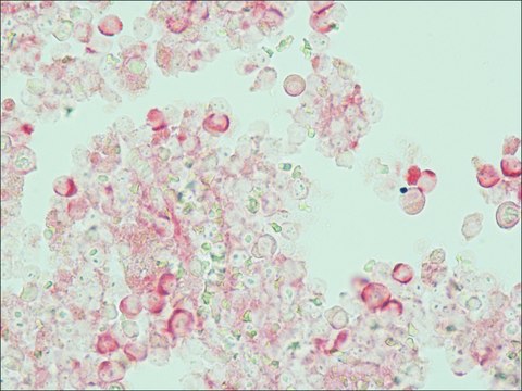 Monoclonal Anti-Bovine IgG&#8722;Alkaline Phosphatase antibody produced in mouse clone BG-18, purified immunoglobulin, buffered aqueous glycerol solution