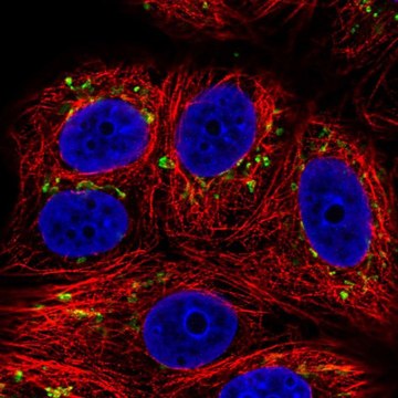 Anti-SLC35E1 antibody produced in rabbit Prestige Antibodies&#174; Powered by Atlas Antibodies, affinity isolated antibody