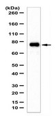 Anti-MLL2 (C-Term) Antibody from rabbit, purified by affinity chromatography