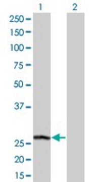 Monoclonal Anti-PSPH antibody produced in mouse clone 3A5, purified immunoglobulin, buffered aqueous solution