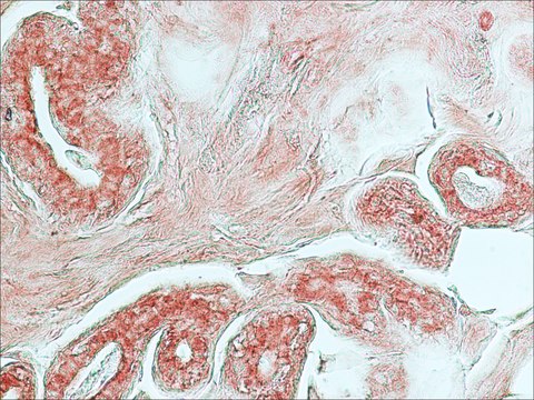 Monoclonal Anti-Cathepsin D antibody produced in mouse clone CTD-19, ascites fluid