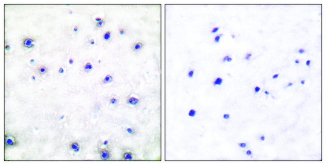 Anti-TRK A antibody produced in rabbit affinity isolated antibody
