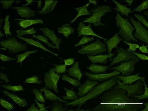 Monoclonal Anti-ABTB1 antibody produced in mouse clone 2A10, purified immunoglobulin, buffered aqueous solution