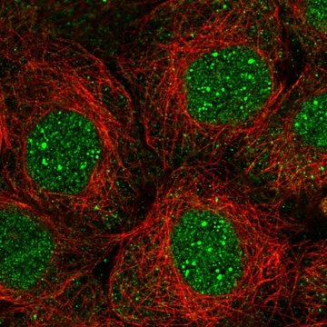 Anti-TMEM62 antibody produced in rabbit Prestige Antibodies&#174; Powered by Atlas Antibodies, affinity isolated antibody