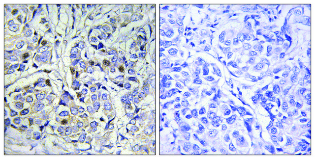 Anti-Centromeric Protein A antibody produced in rabbit affinity isolated antibody