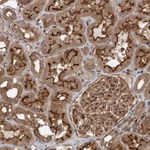 Anti-DHDDS antibody produced in rabbit Prestige Antibodies&#174; Powered by Atlas Antibodies, affinity isolated antibody, buffered aqueous glycerol solution, Ab2