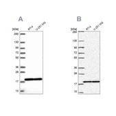 Anti-RPS15 antibody produced in rabbit Prestige Antibodies&#174; Powered by Atlas Antibodies, affinity isolated antibody, buffered aqueous glycerol solution