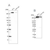 Anti-FASN antibody produced in rabbit Prestige Antibodies&#174; Powered by Atlas Antibodies, affinity isolated antibody, buffered aqueous glycerol solution