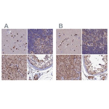 Anti-DNPEP antibody produced in rabbit Prestige Antibodies&#174; Powered by Atlas Antibodies, affinity isolated antibody, buffered aqueous glycerol solution