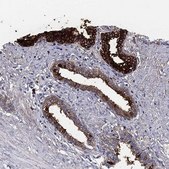 Anti-TGM4 antibody produced in rabbit Prestige Antibodies&#174; Powered by Atlas Antibodies, affinity isolated antibody, buffered aqueous glycerol solution