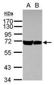 Anti-HSP70 1B antibody produced in rabbit affinity isolated antibody