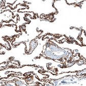 Monoclonal Anti-ITGA8 antibody produced in mouse Prestige Antibodies&#174; Powered by Atlas Antibodies, clone CL7304, purified immunoglobulin, buffered aqueous glycerol solution