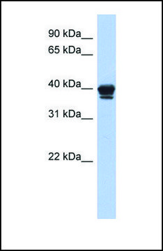 Anti-NAPE-PLD, (N-terminal) antibody produced in rabbit affinity isolated antibody
