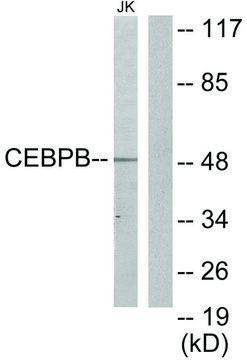 Anti-CEBPB antibody produced in rabbit affinity isolated antibody
